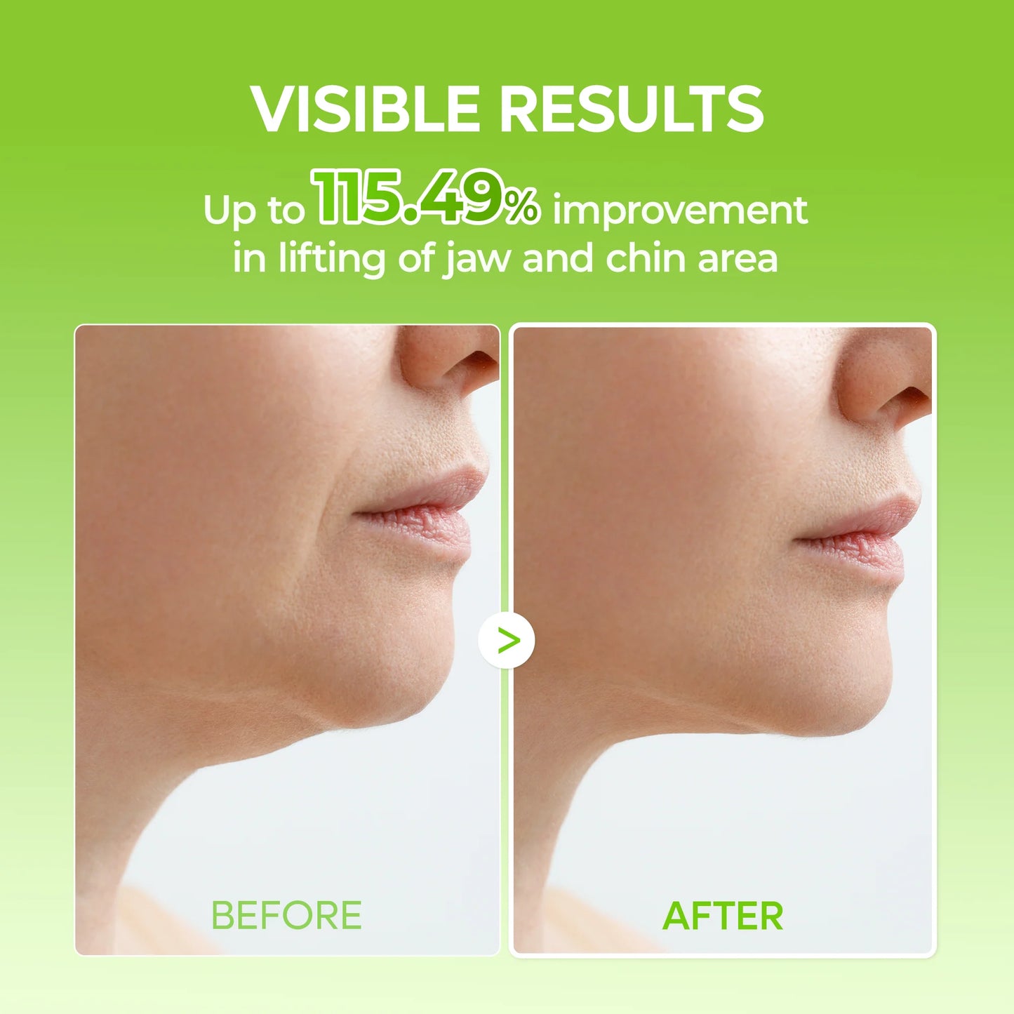 Dr. Melaxin CACTOX V-Lifting Band