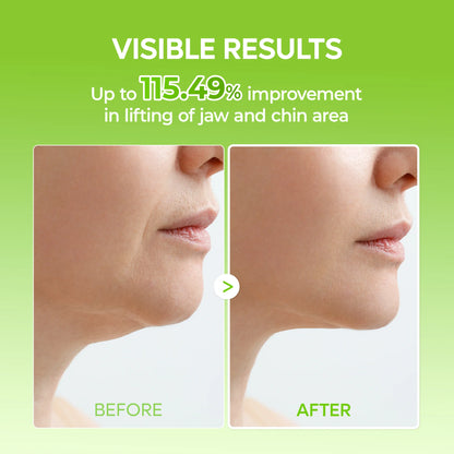 Dr. Melaxin CACTOX V-Lifting Band