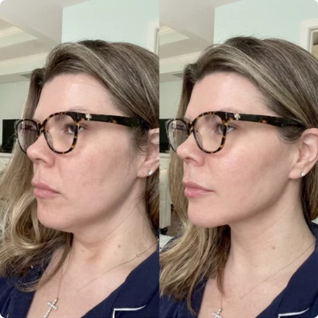 Dr. Melaxin CACTOX V-Lifting Band